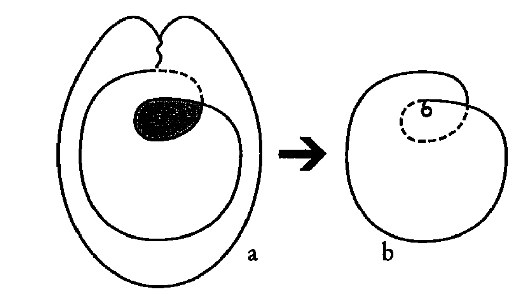 xix a-b